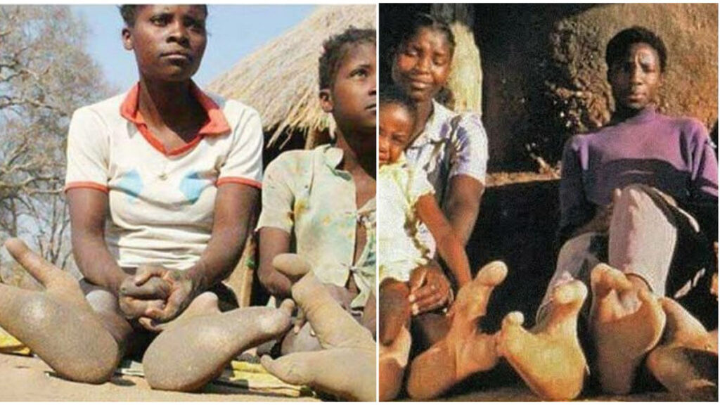 Vadoma tribe feet